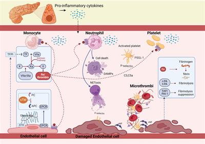 Coagulopathy and acute pancreatitis: pathophysiology and clinical treatment